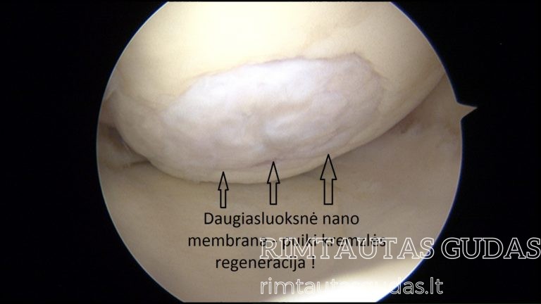 nanomembrana