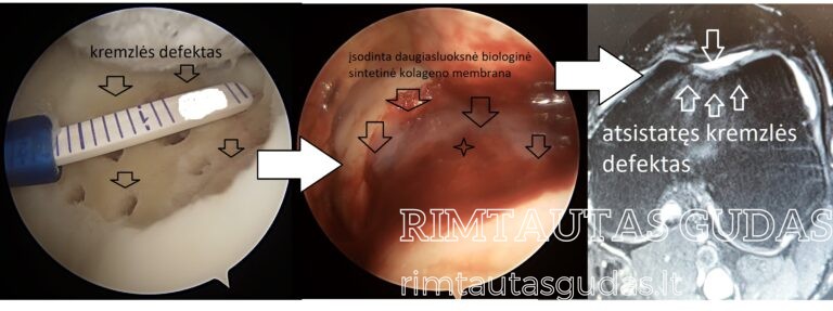 MaioRegenChondroplus 1