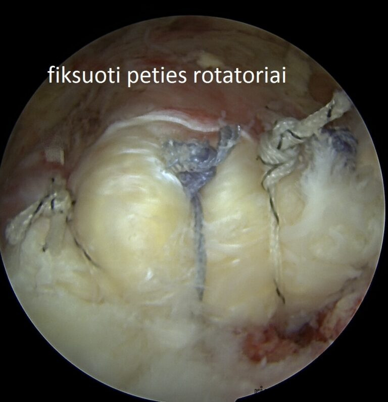 fiksuoti rotatoriai