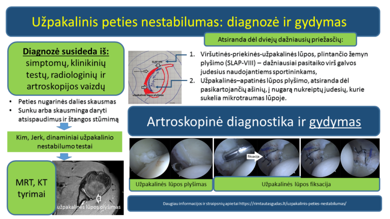 Uzpakalinis peties nestabilumas R.Gudas