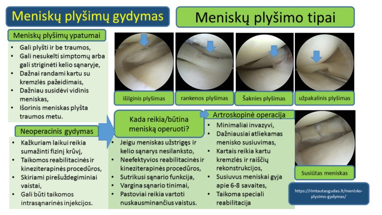 Menisko plysimo gydymas R.Gudas