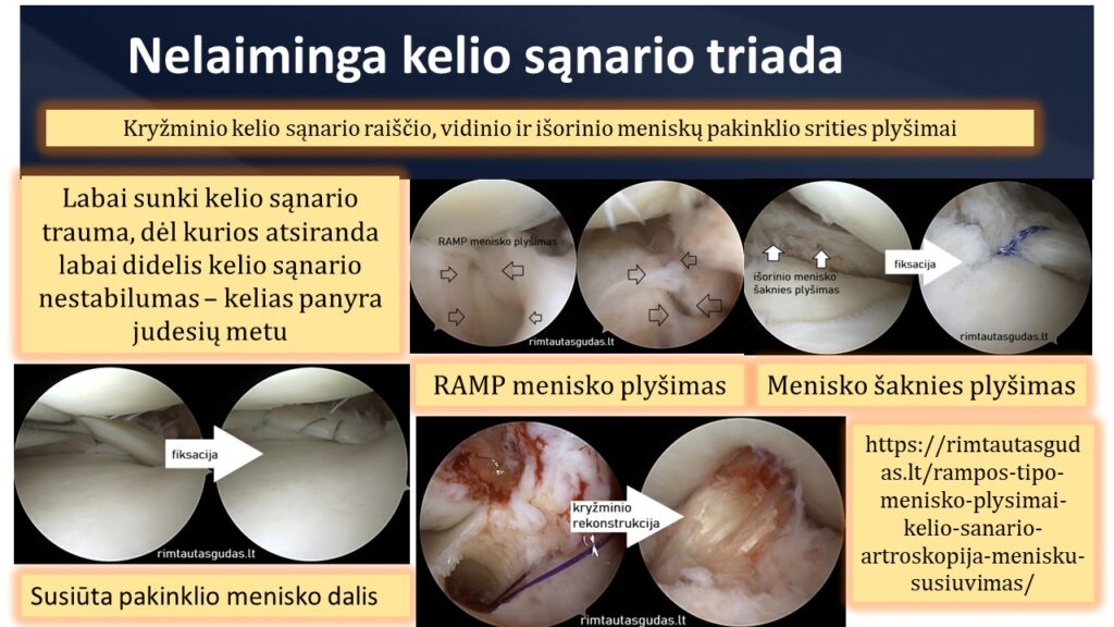 Nelaiminga kelio triada R.Gudas