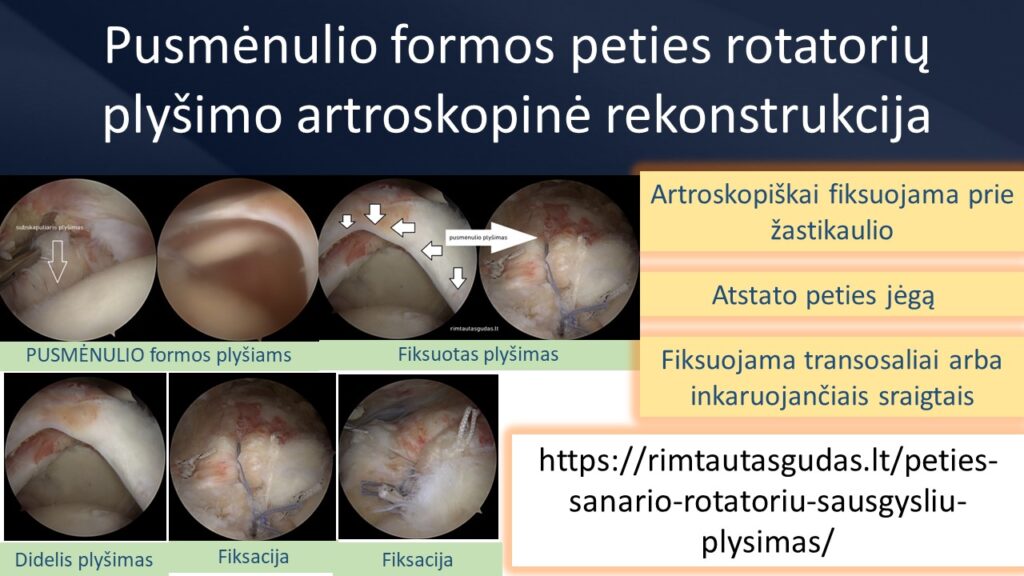 Pusmenulio formos rotatoriu plysimas R.Gudas