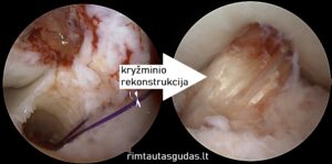 Pradinis 9 kryzminio rekonstrukcija