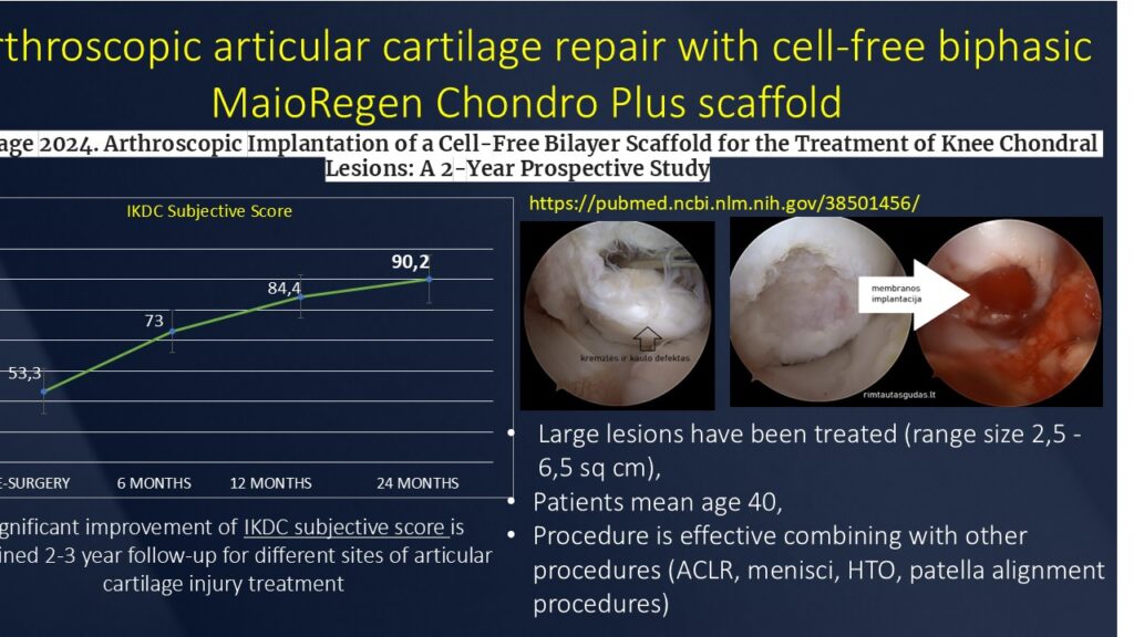 Chondroplus 2 years results R.Gudas