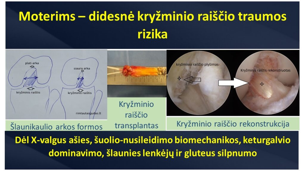 kryzminio trauma moterims