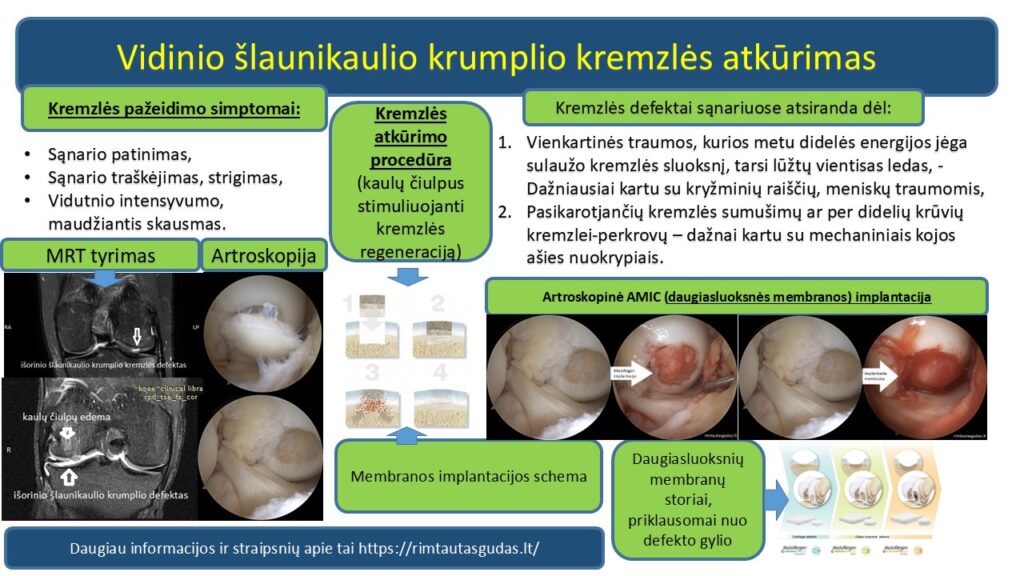 chondroplus MaioRegen implantacija