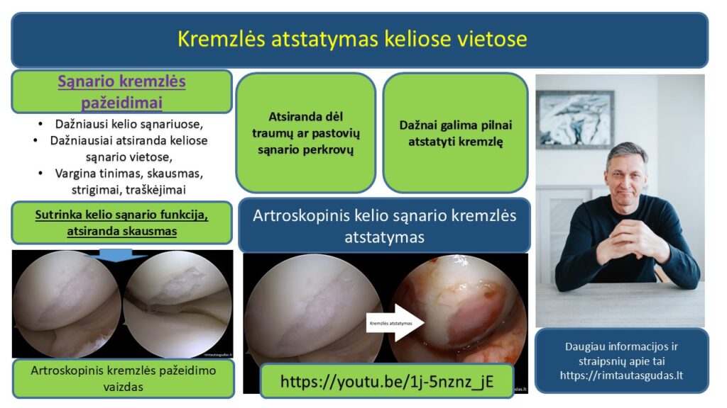 Kremzles atstatymas keliose vietose