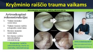 kryzminio raiscio trauma vaikams